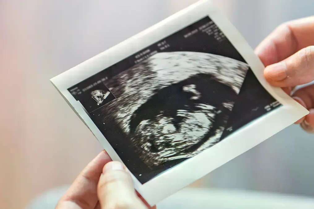 Appeals court defends pro-life centers’ right to share abortion pill reversal information with women