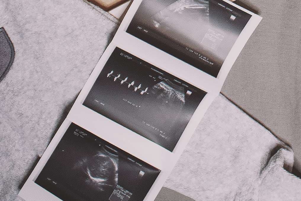 Pro-life victory: Judge orders American College of Obstetricians to release internal communication about abortion pill reversal