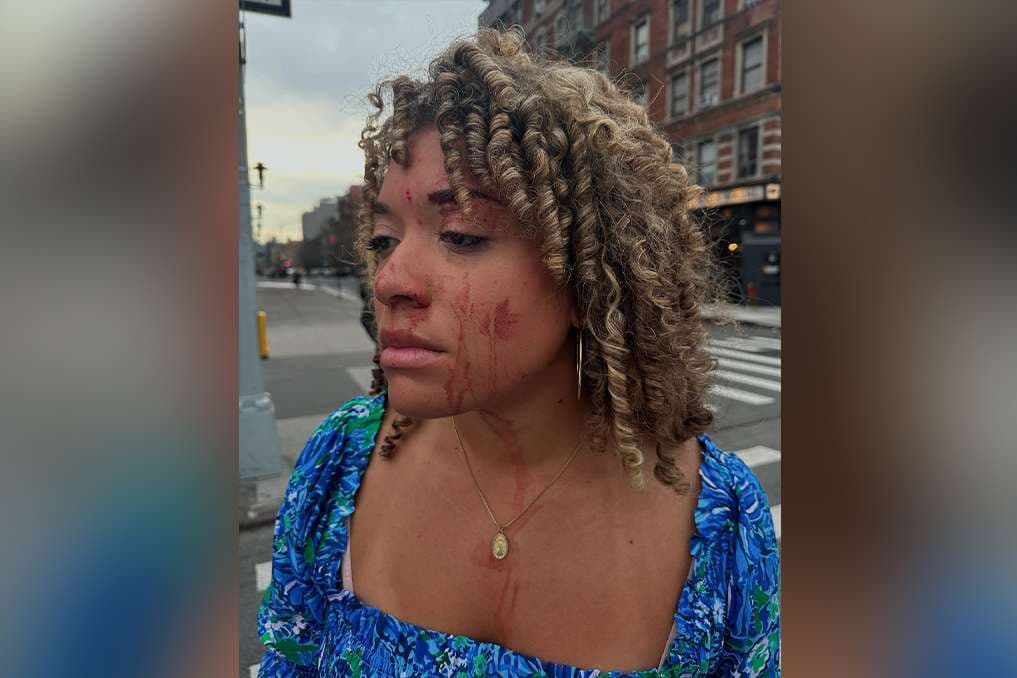 Pro-life journalist assaulted in New York while conducting man-on-the-street interviews