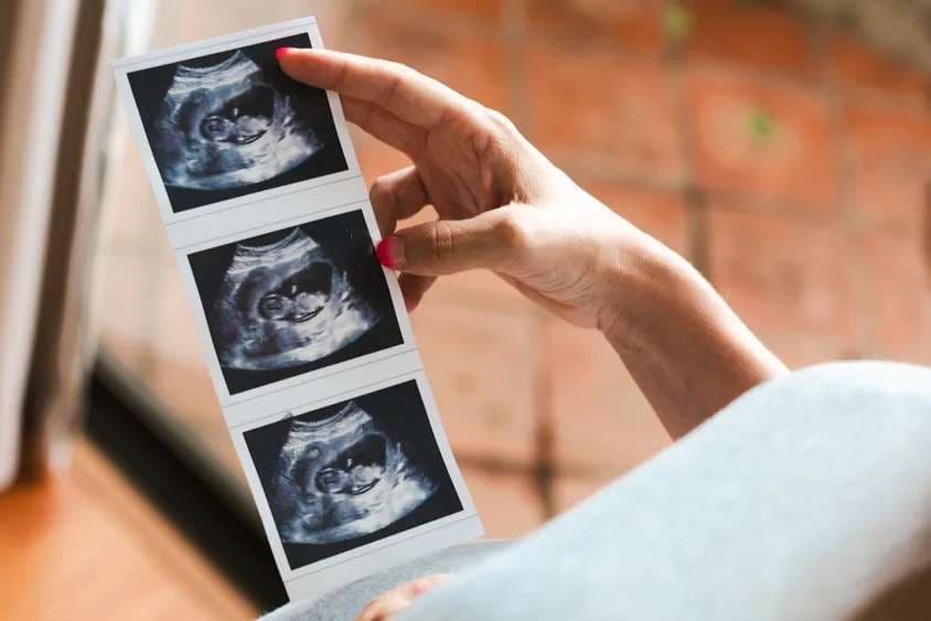 Idaho pro-life pregnancy center seeks to expand services after local hospital closes labor and delivery unit
