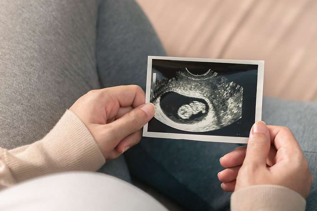 North Dakota Supreme Court upholds law protecting nearly all unborn children in state from abortion