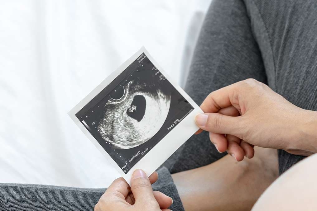 Bill would end shielding for abortion and hormone providers working illegally