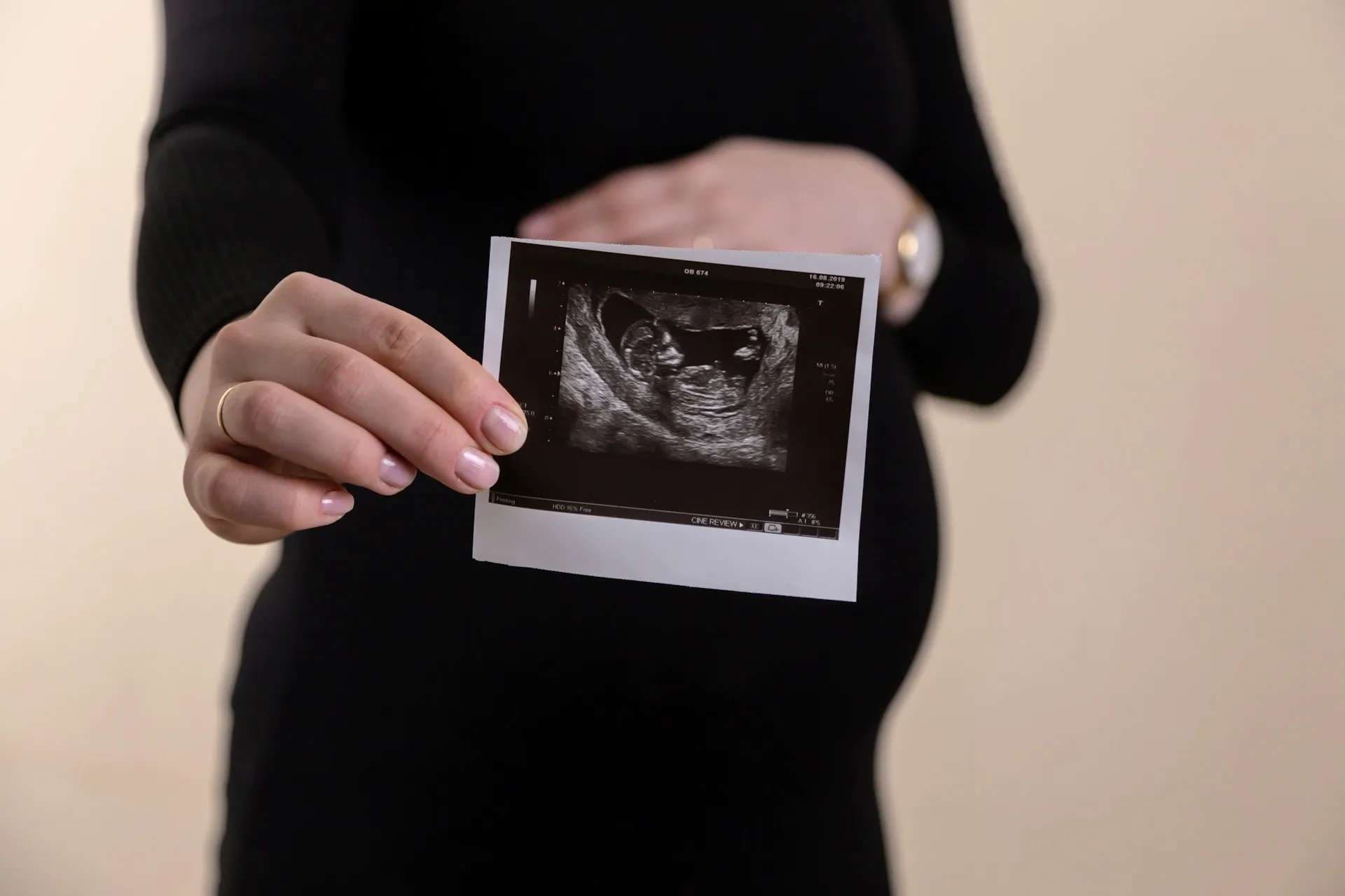 Save the Storks celebrates pregnancy health clinics serving women amid Planned Parenthood closures