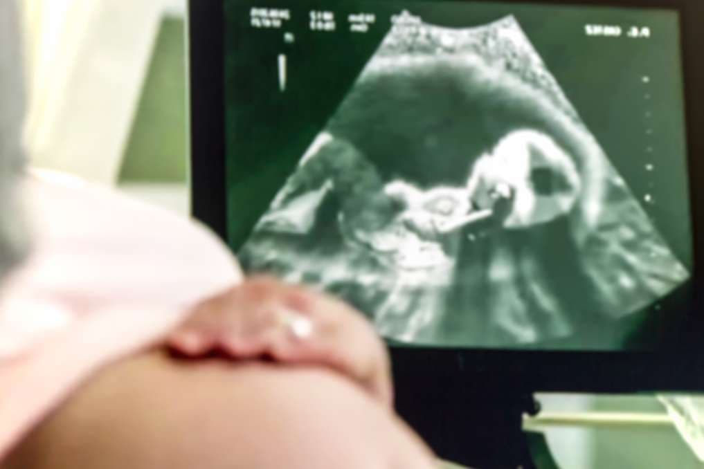 Alaskan pro-lifers to sing Christmas carols outside abortion clinic