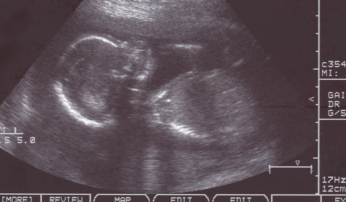 Colorado bishops urge Gov Polis to veto bill allocating $1.5 million per year for abortions