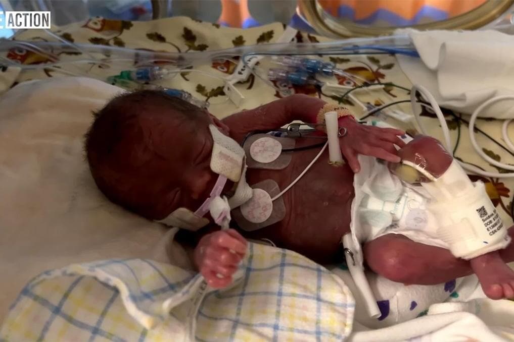 New Live Action video challenges ‘rare’ late-term abortion narrative with hard data